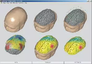 wsi imageoptim hreeg scalp brain map