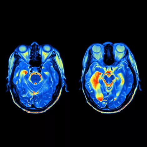 wsi imageoptim coils