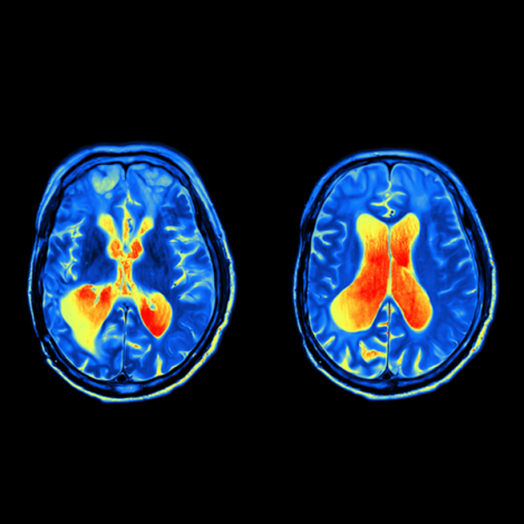 wsi imageoptim eprimefmri