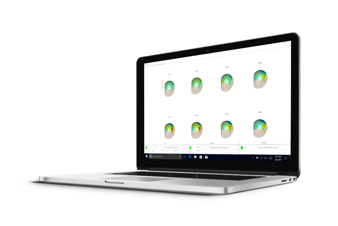 g.bsanalyze software high resolution eeg toolbox